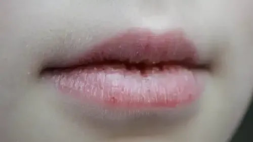 What Does Your Lip Color Reveal About Your Health?